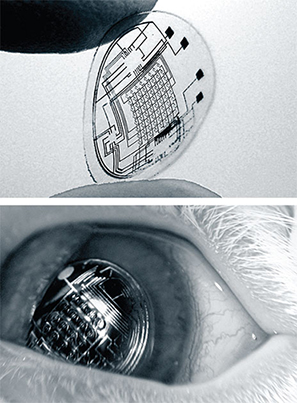 A bionic contact lens
