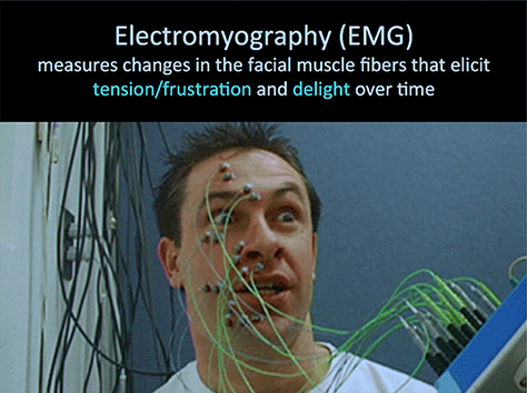 Electromyography