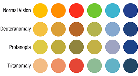 Normal color perception and with three types of color deficits
